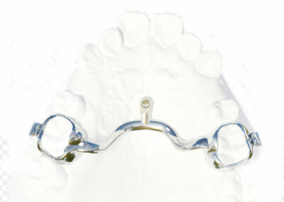 A3DB10-2-Ancrage dentaire incisif ou molaire