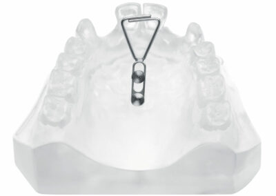 A3DB10-Ancrage dentaire incisif ou molaire