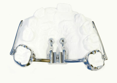 A3DB2-Disjoncteur Hybride hyrax benefit avec bras de traction maxillaire