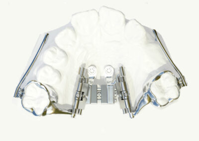 A3DB7-Pendex Benefit Delaire