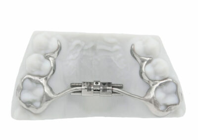 AF1-Disjoncteur palatin sur 2 bagues