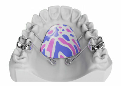 AF10-2-Pendex / Pendulum 2