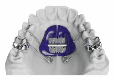 AF10-3-Pendex / Pendulum 3