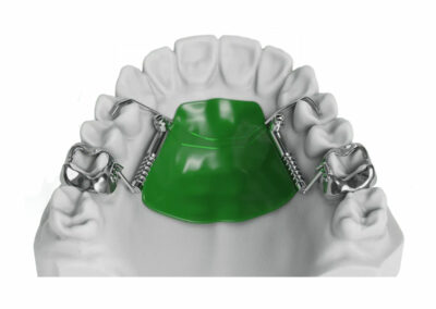 AF10-4-Pendex / Pendulum 4