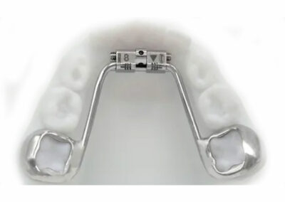 AF4-Disjoncteur mandibulaire