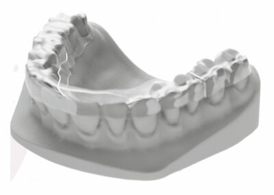 AI2-Gouttière de Michigan ou autre