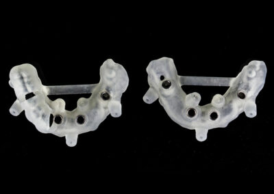 AI7-Guide pour pose des minivis / implants