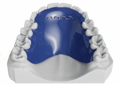 AM1-3-Plaque de Hawley