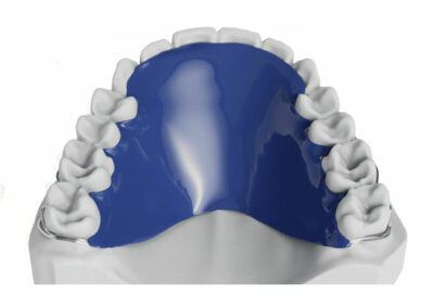 AM1-4-Plaque de Hawley