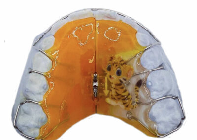 AM2-2-Plaque avec vérin d'expansion