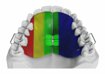 AM2-Plaque avec vérin d'expansion