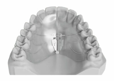 AM3-Plaque avec ouverture en éventail