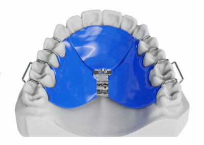 AM7-Plaque avec vérin en 3D (en Y)