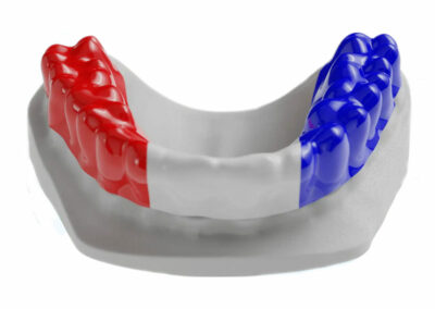 AM9-Protège dents personnalisées