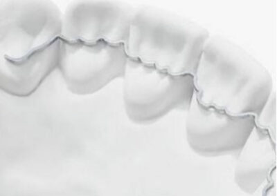 Appareil de contentions orthodontiques
