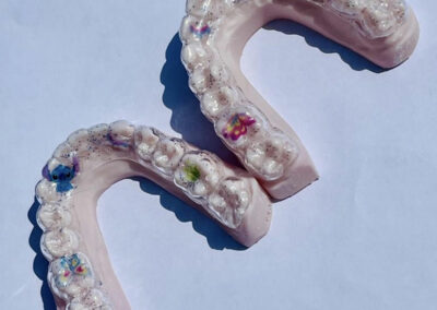 Appareil de contentions orthodontiques