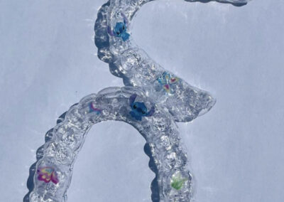 Appareil de contentions orthodontiques