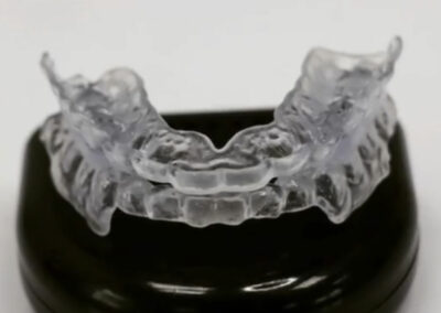 Appareil de contentions orthodontiques