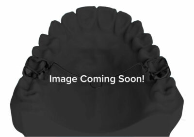 AI6-Impression arcade avec socle